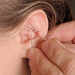 Ear stapling